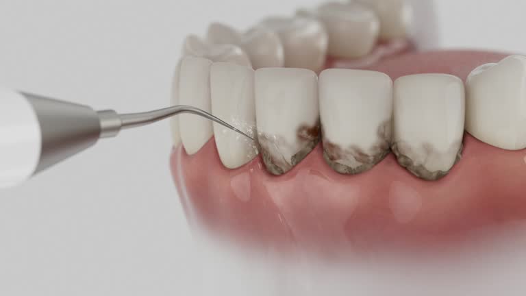 Reliable Tooth Extraction contractor in Sterling, AK by Smile Center Dentistry